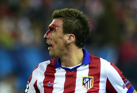 Mandzukic krijgt rake klappen