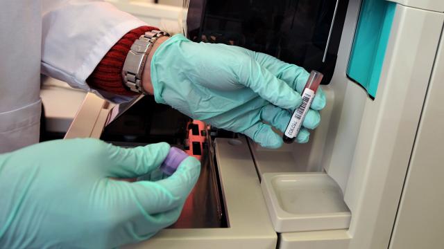 WADA schorst enige Afrikaanse dopinglaboratorium
